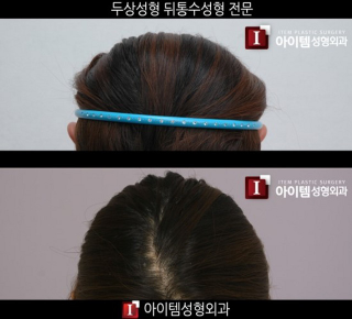 Illustration for article titled "Round Head" Plastic Surgery Seems Excessive, Even for South Korea